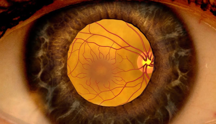 eye problems,eyes care,eye problem,blurred vision,lazy eye,diabetic retinopathy,cataract,glaucoma,blepharitis,crossed eyes,Health