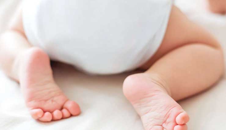 5 Home Remedies To Prevent Diaper Rashes in Children