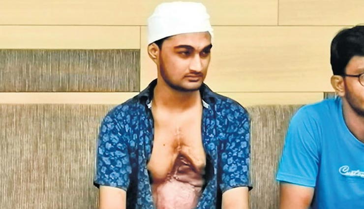 इस शक्स को लगा था 11 हजार वोल्ट का झटका, बाहर आ गया था दिल, डॉक्टरों ने ऑपरेशन कर बचाई जान