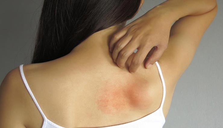 weird disease,rushes on body,after pregnancy disease,rushes touching to water,cherel farugiya,aquagenic articeria