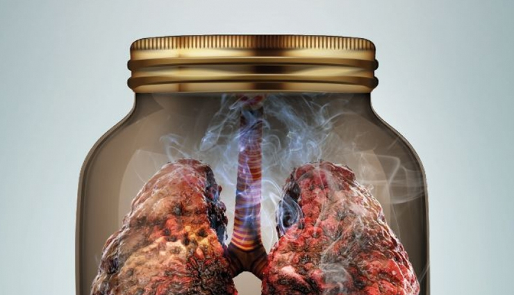 World No Tobacco Day- 10 Harmful Diseases Caused By Tobacco