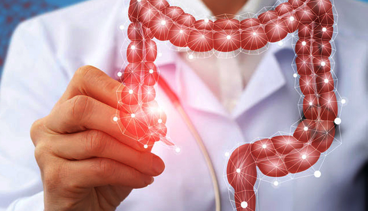 16 Natural Remedies To Treat Diverticulitis