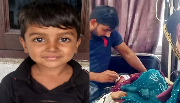 राजस्‍थान: भीलवाड़ा में कुत्ते ने नोच डाला 5 साल के बच्चे का चेहरा, लगाने पड़े 100 टांके