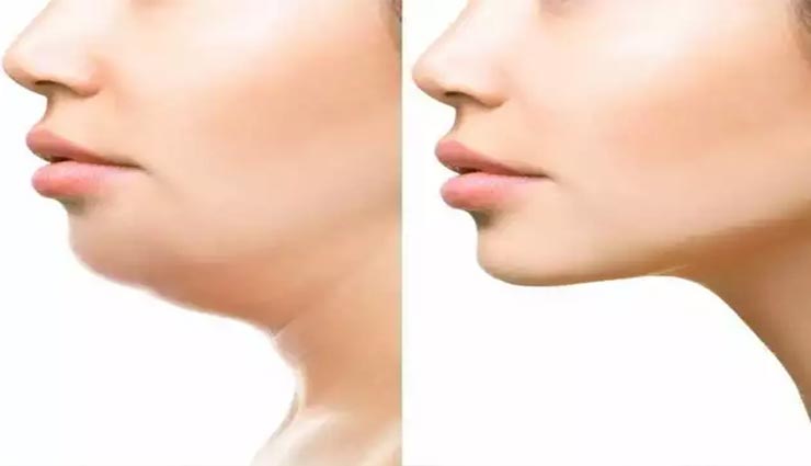 ये 4 चीजें दिलाएगी डबल चिन से छुटकारा, बढ़ेगी खूबसूरती 