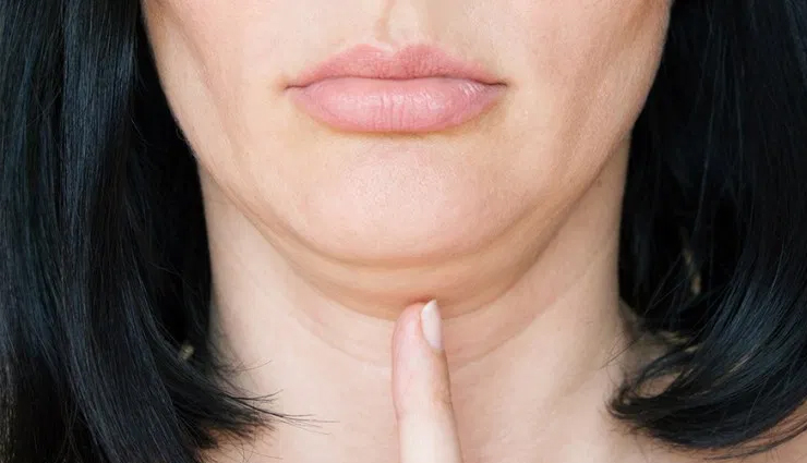 6 Exercises To Help You Reduce Double Chin