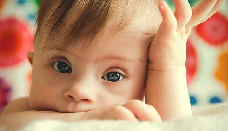 rare diseases in newborns,common diseases in newborns,genetic disorders in newborns,metabolic disorders in newborns,congenital anomalies in newborns,down syndrome in newborns,turner syndrome in newborns,fragile x syndrome in newborns,tay-sachs syndrome in newborns,phenylketonuria (pku) in newborns,orphan diseases in newborns,newborn health disorders,genetic conditions in infants,metabolic diseases in infants,rare congenital diseases in babies