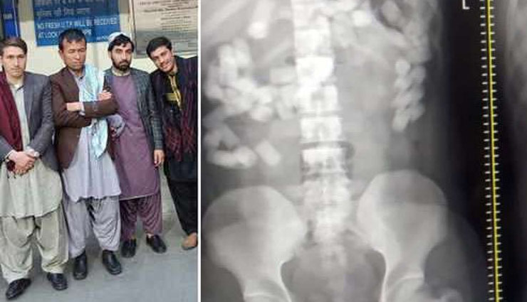 पेट में छिपाकर लाए 10 करोड़ की ड्रग्स, एयरपोर्ट पर गिरफ्तार, 10 दर्जन केले खिलाकर निकलवाई