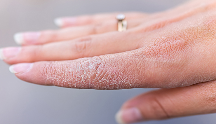 benefits of using a hand cream,importance of hand cream,why use hand cream,hand cream for dry hands,hand cream for aging hands,hand cream for cracked hands,nourishing hand cream,hydrating hand cream,hand cream for sensitive skin,hand cream for damaged nails,hand cream for cuticles,hand cream for daily use,hand cream for environmental protection,best hand creams for moisturizing,natural hand creams for skin rejuvenation