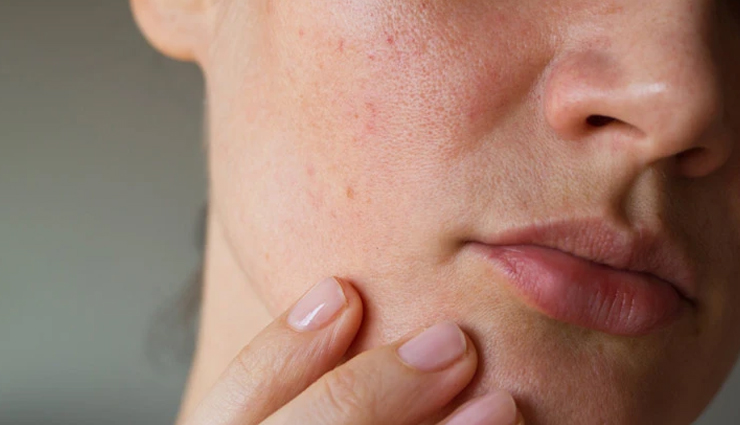 इम्यूनिटी कमजोर होने पर बॉडी देती हैं ये संकेत, जानें और सेहत का रखें ध्यान symptoms of a weak immune system,causes weak immunity,signs of a weak immune system,weak immune system,warning signs of weak immunity,cure a weak immune system,immune system at home,immune system weaken,Health,health news