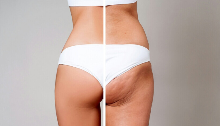 dry brushing,beauty benefits of dry brushing,skin care tips,beauty tips