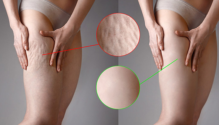 dry brushing,benefits of dry brushing,beauty benefits,skin care tips,beauty tips