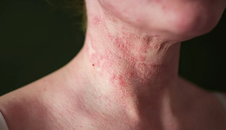 dry brushing,beauty benefits of dry brushing,skin care tips,beauty tips