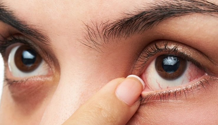 क्या फिर से लौट रहा हैं कोरोना? कमजोर इम्यूनिटी के इन लक्षणों को जान, हो जाएं सतर्क weak immunity and coronavirus,signs of weak immune system during covid-19 crisis,vulnerability to coronavirus due to weak immunity,strengthening immune system during pandemic,boosting immunity to fight covid-19,how to tell if your immune system is weak during corona crisis,immune system and susceptibility to coronavirus,immune-boosting tips during corona crisis,correlation between weak immunity and severity of coronavirus,role of strong immunity in fighting covid-19