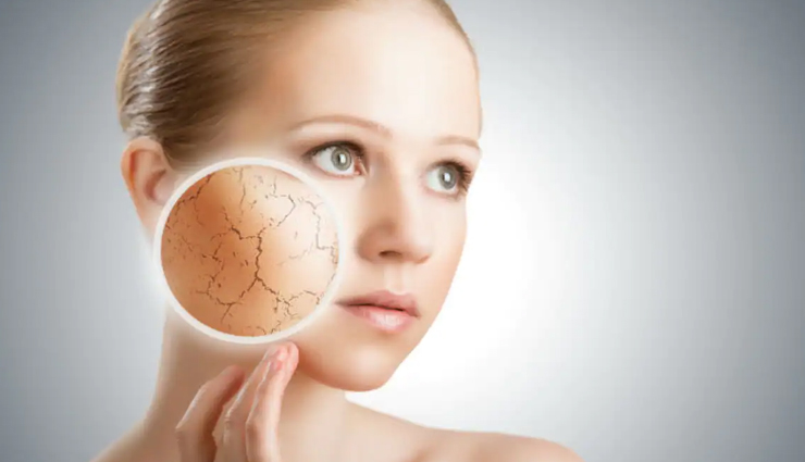 रूखी स्किन को इन होममेड मॉइश्चराइजर की मदद से बनाए जवां 