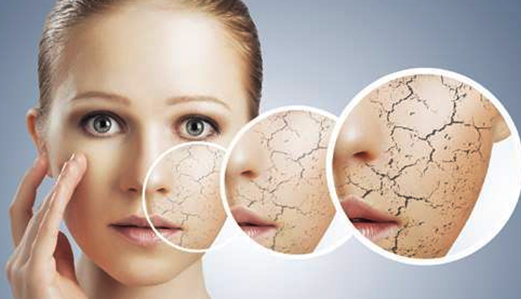 Easy Home Remedies To Get Rid of Dry, Flaky Skin on Face