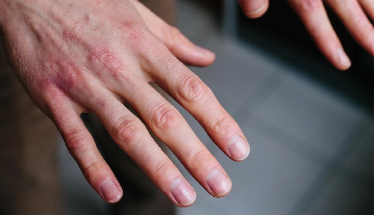 coconut oil benefits,coconut oil for skin,natural skin moisturizer,anti-inflammatory oil,antibacterial skincare,coconut oil for dry skin,coconut oil for aging skin,diy beauty remedies,natural skincare ingredients,moisturizing oil