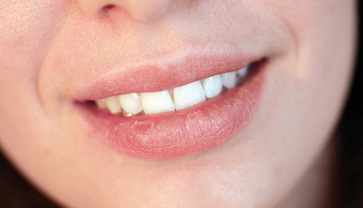 dry lips,home remedies,home remedies for dry lips,lip care tips,skin care tips,beauty tips