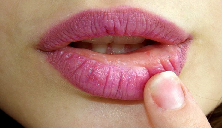 dry lips,home remedies,home remedies for dry lips,lip care tips,skin care tips,beauty tips