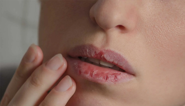 dates,beauty benefits of skin,dates benefits for skin,dates beauty benefits,beauty,skin care tips,beauty tips