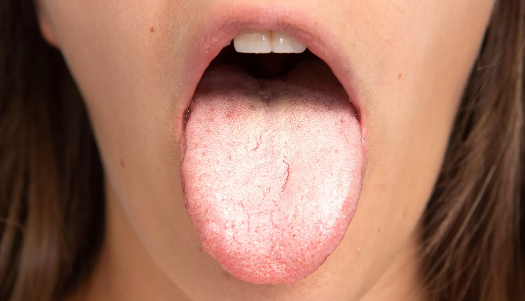 oil pulling benefits,health advantages of oil pulling,oil pulling for oral health,natural oral care with oil pulling,ayurvedic oil pulling benefits,coconut oil pulling benefits,improved dental health through oil pulling,detoxification benefits of oil pulling,oil pulling and gum health,daily oil pulling routine