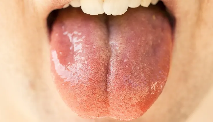 importance of drinking water,signs of dehydration,health benefits of water,morning hydration tips,how much water to drink daily,dehydration symptoms,benefits of drinking water,copper water health benefits,stay hydrated naturally,water for detox and wellness