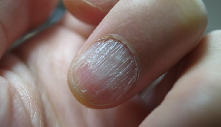 health warnings hands,signs of health issues hands,nail color health warning,swollen fingers health sign,tingling hands causes,dry skin health warning,hand shape deformities,health clues from hands,hands reveal health problems,health conditions visible in hands