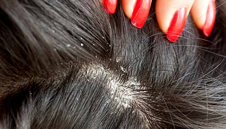 lifeless hair,hair care tips,ghee for hair,hair treatment,hair,beauty,beauty tips