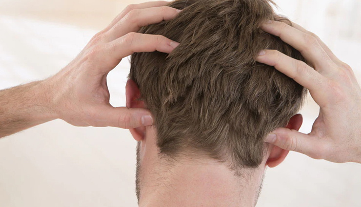 8 Effective Home Remedies To Treat Dry Scalp