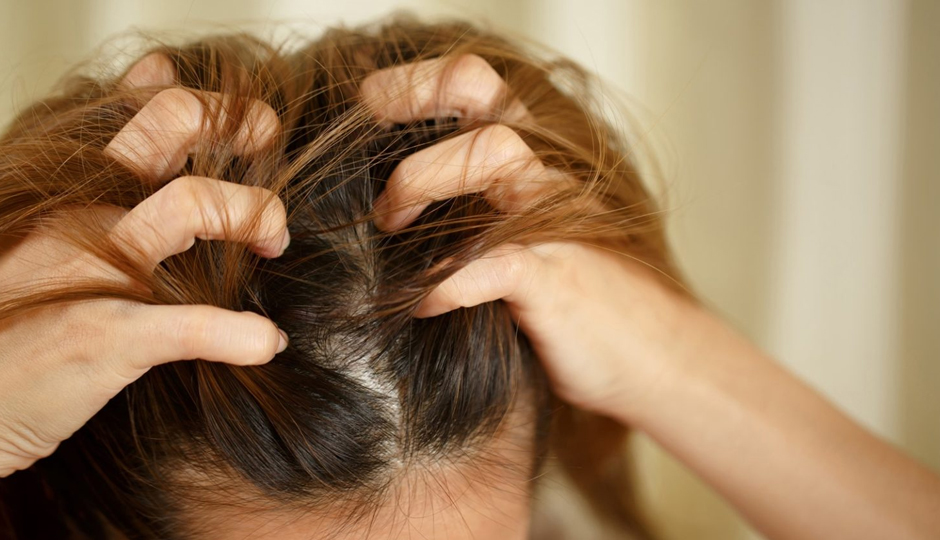 7 Must Try Home Remedies to Treat Dry Scalp in Winters