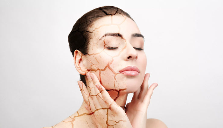dry skin,ayurvedic ways to treat dry skin,skin care tips,beauty tips