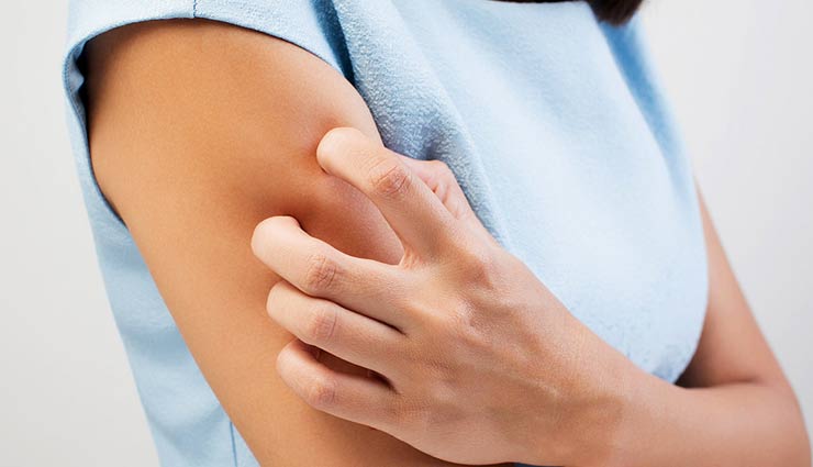 beauty tips,skin care tips,monsoon skin care tips,tips for all skin types,monsoon tips