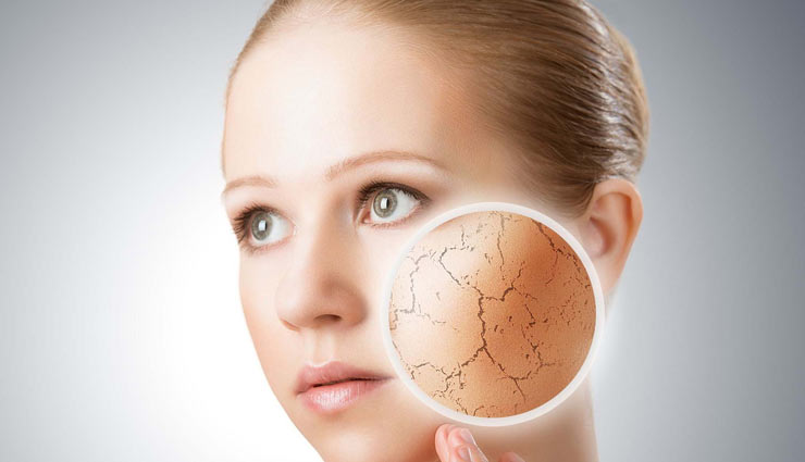 ये 4 गलतियां बनती हैं त्वचा के रूखेपन का कारण, जानें और बचे इनसे 
