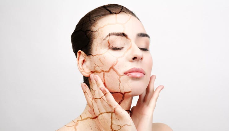 त्वचा के रूखेपन का कारण बनती हैं ये 4 गलतियां, करें अपना बचाव