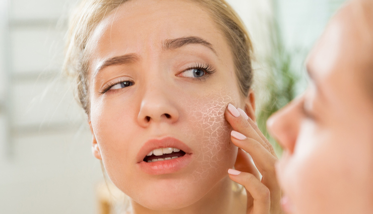 5 Tips To Maintain Dry Skin During Summer