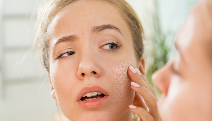 Best Food You Must Eat To Treat Dry Skin