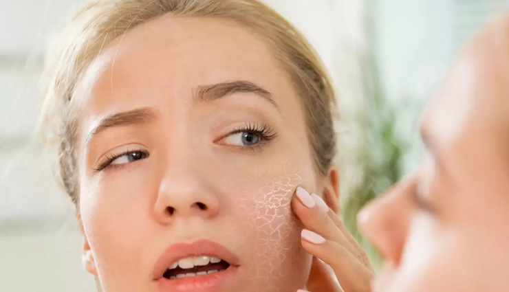 5 DIY Potato Face Mask To Treat Dry Skin