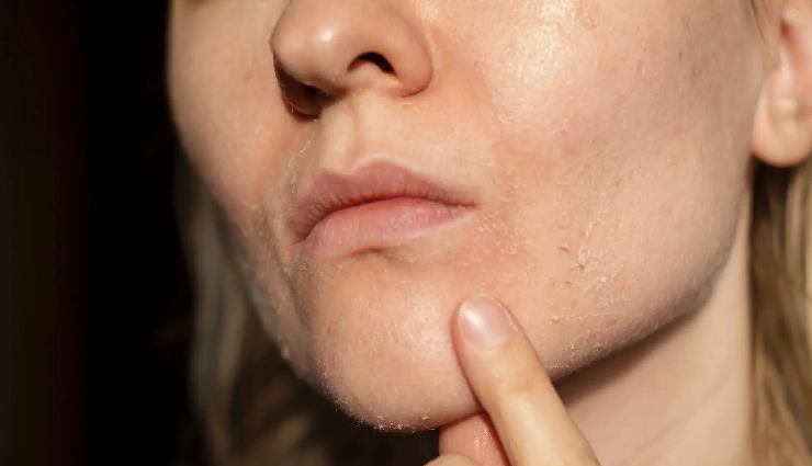 facial health signs,skin tone changes,face and internal health,facial symptoms of disease,face reveals health issues,skin texture problems,sudden face changes,facial warning signs,health diagnosis by face,nutrition and skin health