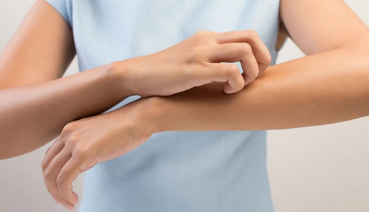 10 Effective Home Remedies To Treat Dry Skin