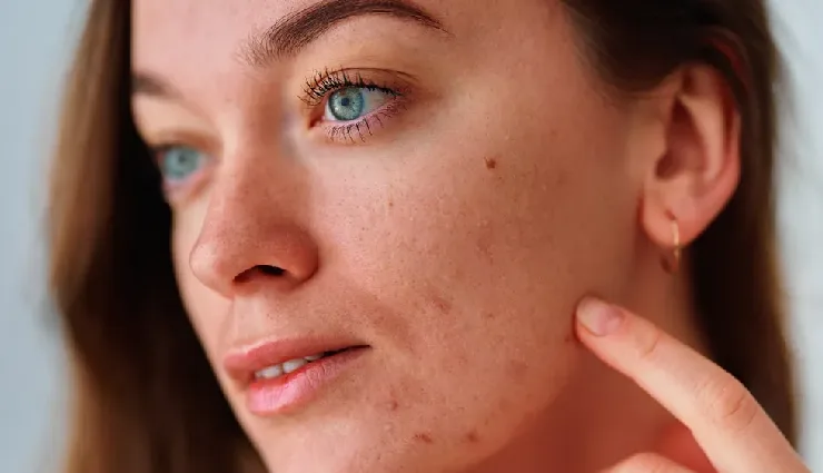 aloe vera benefits for skin,aloe vera for acne,aloe vera for glowing skin,natural skincare remedies,aloe vera gel uses,hydrating aloe vera,aloe vera for sunburn,aloe vera healing properties,skincare with aloe vera,aloe vera home remedies,anti-inflammatory aloe vera,aloe vera moisturizer,aloe vera for irritation,plant of immortality skin benefits,natural skin healing