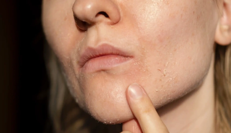 honey for skin,benefits of honey for skin,honey skincare remedies,natural moisturizer honey,honey for glowing skin,acne treatment with honey,home remedies for healthy skin,honey face mask,honey for dry skin,natural skin care ingredients