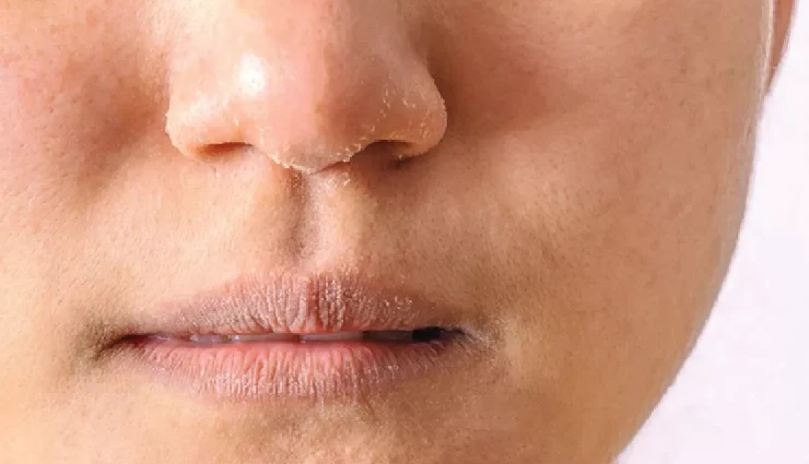 curd for skin,curd for hair,yogurt beauty benefits,dahi for glowing skin,curd hair mask,curd for dandruff,yogurt for acne,curd home remedies,natural skin care with curd,diy hair care with yogurt