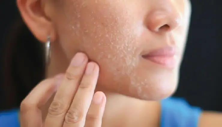 honey for skin,natural skincare,acne treatment,moisturize skin naturally,reduce scars,lighten dark spots,radiant skin,antibacterial honey,skin hydration,soothe irritated skin,natural beauty remedies