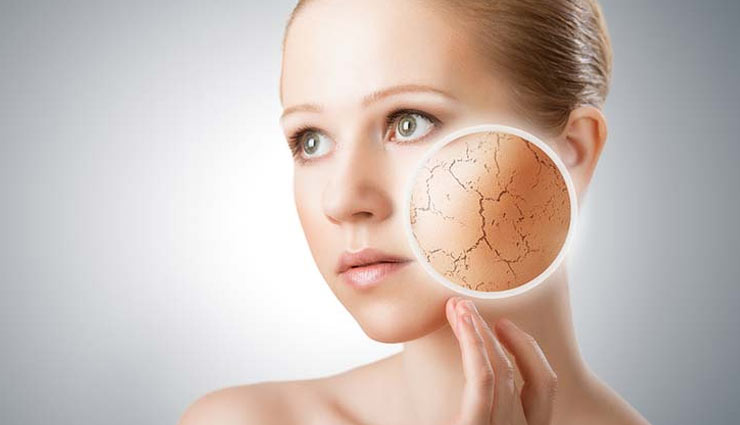 dry skin,ayurvedic ways to treat dry skin,skin care tips,beauty tips