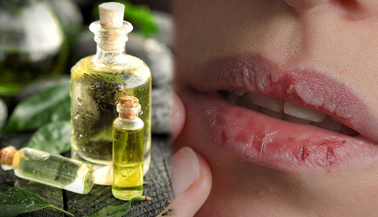 tea tree oil for skin,tea tree oil benefits,tea tree oil for face,tea tree oil used in allergy,tea tree oil remove bacterial infection,tea tree oil for warts,tea tree oil for breath and body odour,tea tree oil for dry skin and chapped lips,tea tree oil for wounds,beauty,beauty tips