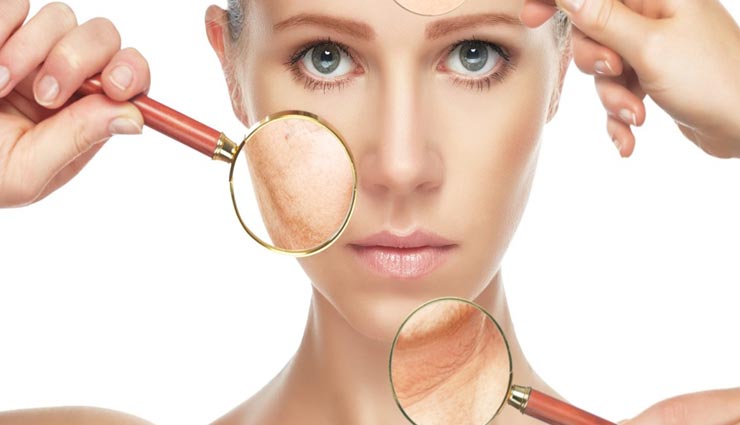 त्वचा का रूखापन बनता हैं सर्दियों की बड़ी समस्या, इन बेहतरीन उपायों से पाए खूबसूरती