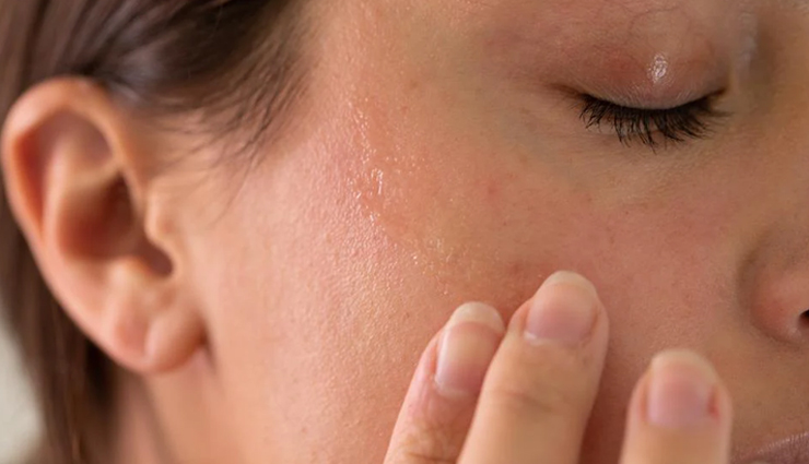 6 DIY Natural Moisturizers To Treat Dry Skin