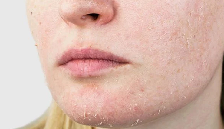 diy kaolin clay face masks,kaolin clay face mask recipes,homemade face masks with kaolin clay,benefits of kaolin clay for skin,natural face masks for beautiful skin,kaolin clay skincare routine,diy beauty treatments with kaolin clay,kaolin clay face mask benefits,best kaolin clay face mask recipes,enhancing skin with kaolin clay masks