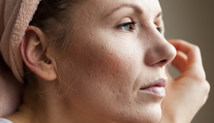 make-up on dry skin may have to be heavy in winter these damages the skin,beauty tips,beauty hacks