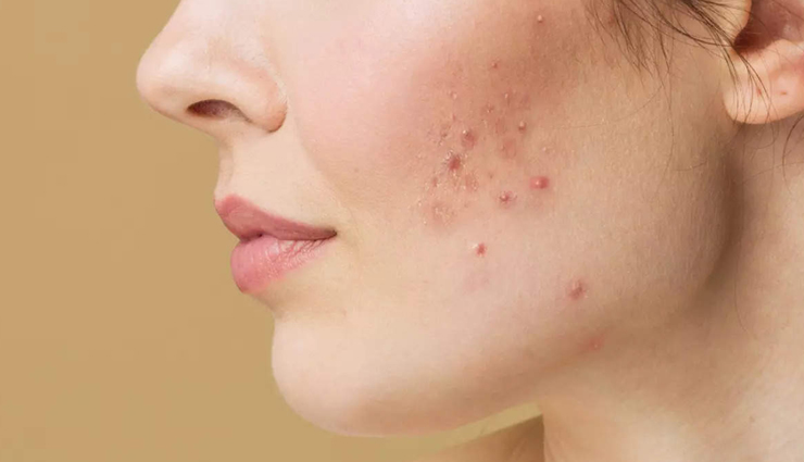 make-up on dry skin may have to be heavy in winter these damages the skin,beauty tips,beauty hacks