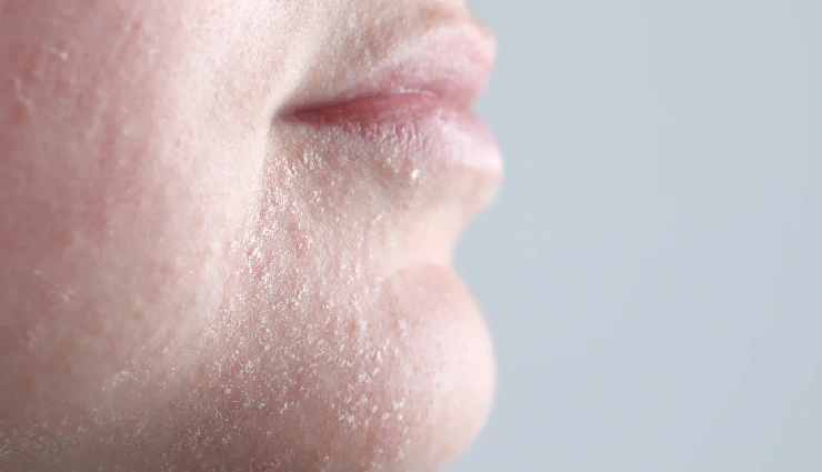 black sesame seeds benefits,black sesame seeds for skin,black sesame seeds for hair,antioxidants for skin,natural beauty tips,sesamol benefits,vitamin e for hair,healthy hair remedies,glowing skin naturally,ayurvedic beauty secrets